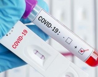 183 нови случая на коронавирус у нас
